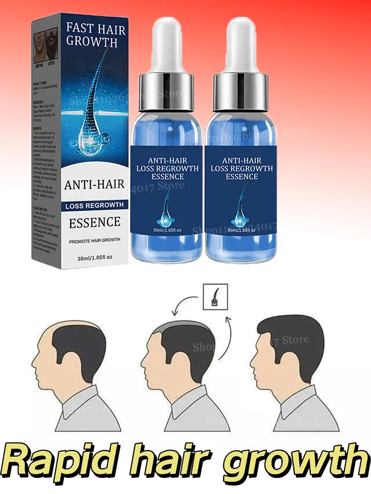 Fast Hair Growth Essence – Anti-Hair Loss & Regrowth Formula