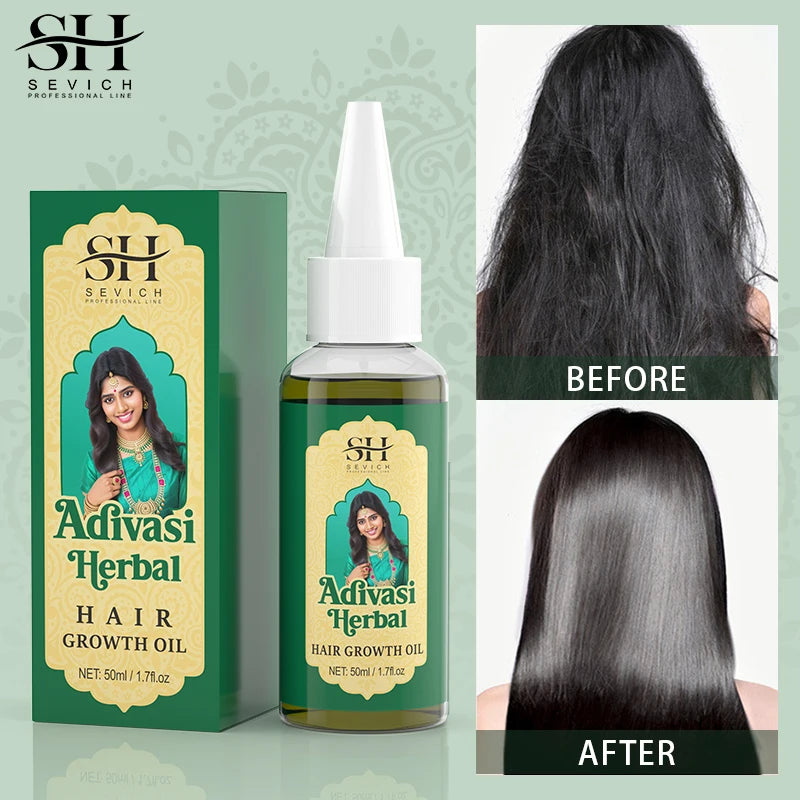 Adivasi Herbal Hair Growth Oil bottle — natural herbal hair growth treatment