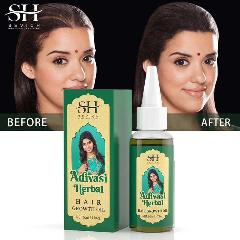 Adivasi Herbal Hair Growth Oil bottle — natural herbal hair growth treatment