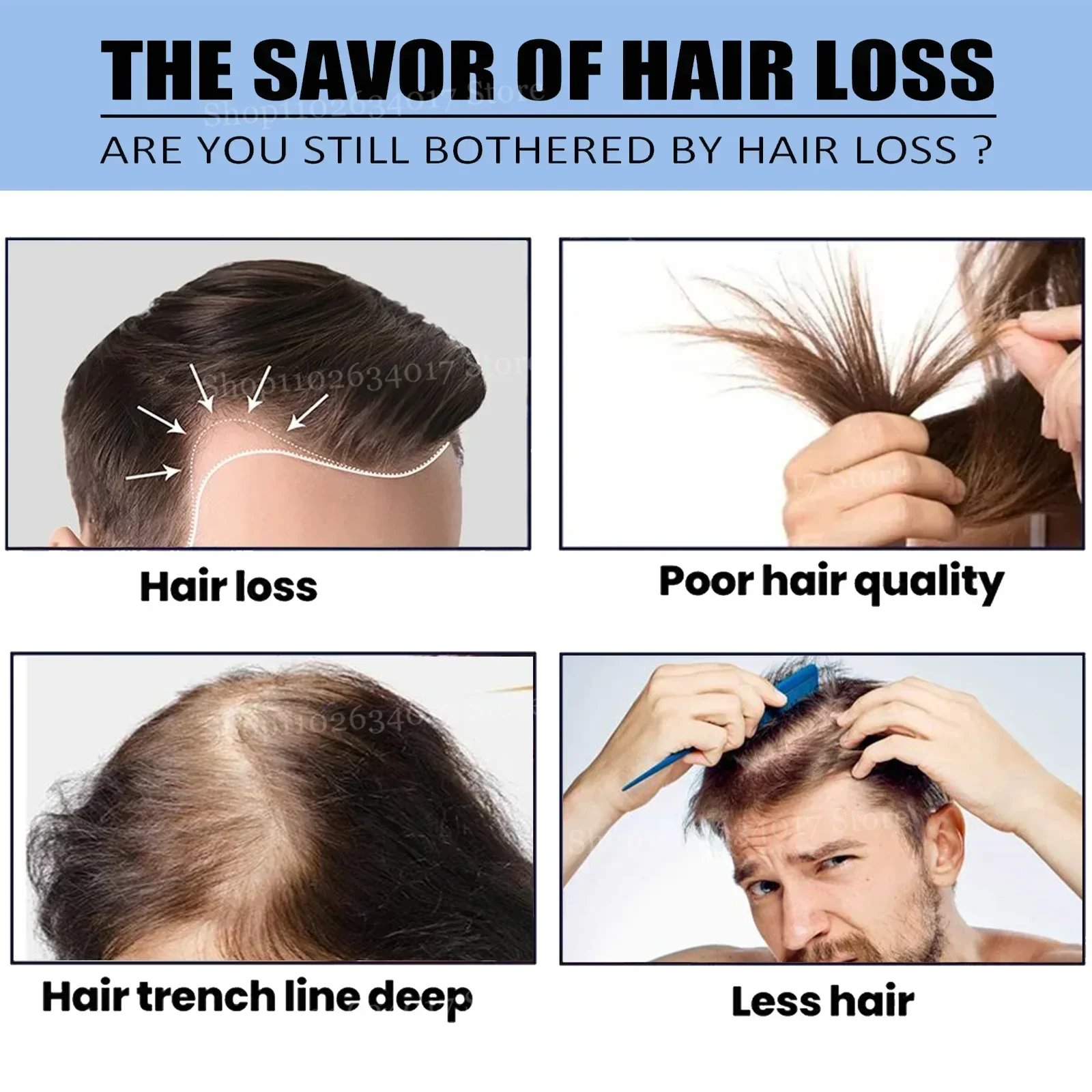 Fast Hair Growth Essence – Anti-Hair Loss & Regrowth Formula